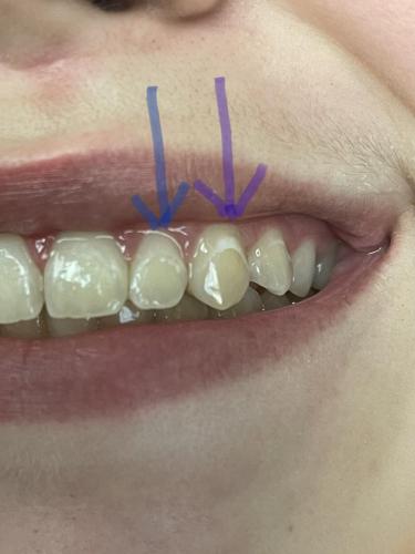 Before